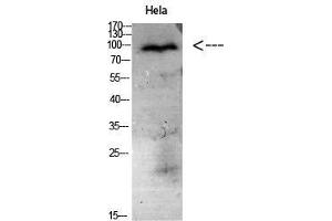 Western Blot (WB) analysis of HeLa cells using Antibody diluted at 1:1000. (CD56 anticorps)