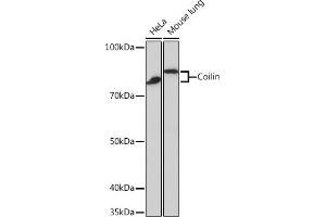 Western blot analysis of extracts of various cell lines, using Coilin Rabbit mAb (ABIN7266451) at 1:1000 dilution. (Coilin anticorps)