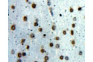 Used in DAB staining on fromalin fixed paraffin- embedded Kidney tissue (STAT1 anticorps  (AA 343-602))