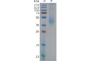Human GFRAL Protein, His Tag on SDS-PAGE under reducing condition.