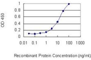 anti-Chromosome 2 Open Reading Frame 62 (C2orf62) (AA 1-387) antibody