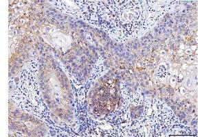 IHC analysis of Poliovirus Receptor/PVR using anti-Poliovirus Receptor/PVR antibody (ABIN7601071). (Poliovirus Receptor anticorps  (AA 28-331))