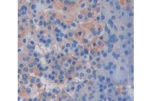 IHC-P analysis of Human Tissue, with DAB staining. (IL17B anticorps  (AA 21-180))