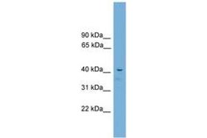Image no. 1 for anti-Adrenocortical Dysplasia Homolog (ACD) (C-Term) antibody (ABIN6744514) (ACD anticorps  (C-Term))