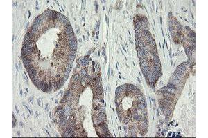 Image no. 2 for anti-Methionyl Aminopeptidase 2 (METAP2) (AA 2-212) antibody (ABIN1491153) (METAP2 anticorps  (AA 2-212))