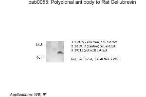Image no. 1 for anti-Vesicle-Associated Membrane Protein 3 (VAMP3) (N-Term) antibody (ABIN347007)