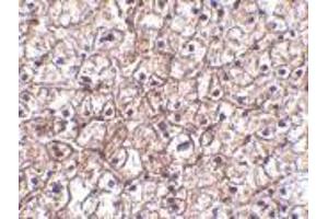 Immunohistochemistry of IFN-b in human liver tissue with IFN-b antibody at 5 μg/ml.