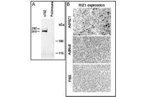 A) Rat B50 brain tumor cell extracts were immunoprecipitated with RIZ1 antibody (cat (ABIN388010 and ABIN2845353)) or preimmune (ref. (PRDM2 anticorps  (AA 245-573))