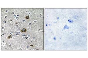 Immunohistochemistry (IHC) image for anti-A Kinase (PRKA) Anchor Protein 1 (AKAP1) (Internal Region) antibody (ABIN1849848) (AKAP1 anticorps  (Internal Region))