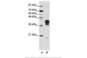 Image no. 2 for anti-Heterogeneous Nuclear Ribonucleoprotein D (HNRNPD) (C-Term) antibody (ABIN203266) (HNRNPD/AUF1 anticorps  (C-Term))