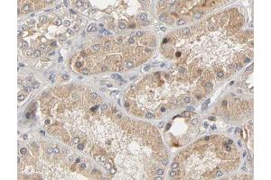 ABIN6267474 at 1/200 staining human kidney tissue sections by IHC-P. (AKT1 anticorps  (pSer473))