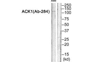 Western Blotting (WB) image for anti-tyrosine Kinase, Non-Receptor, 2 (TNK2) (Tyr284) antibody (ABIN1847978) (TNK2 anticorps  (Tyr284))