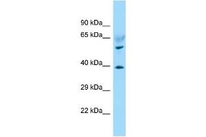 WB Suggested Anti-LPAR6 Antibody Titration: 1. (LPAR6 anticorps  (C-Term))