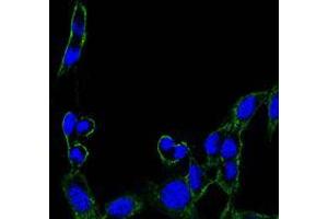 Immunofluorescence analysis of B16 cells using FAK mouse mAb (green).