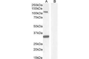 ABIN1589992 (1µg/ml) staining of Human Hippocampus lysate (A) + peptide (B) (35µg protein in RIPA buffer).