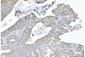 IHC analysis of Cytokeratin 5 using anti-Cytokeratin 5 antibody (ABIN7602992). (Cytokeratin 5 anticorps  (Middle Region))