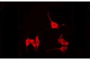 ABIN6274828 staining COLO205 by IF/ICC.