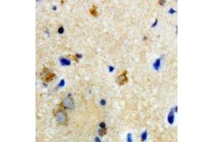 Immunohistochemical analysis of Biotinidase staining in rat brain formalin fixed paraffin embedded tissue section. (BTD anticorps)