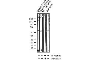 Western blot analysis of Phospho-GABA-RB (Ser434) expression in various lysates (GABA-RB (pSer434) anticorps)