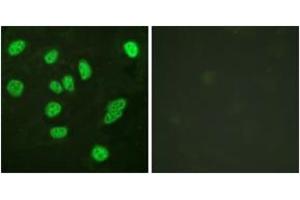 Immunofluorescence analysis of HeLa cells, using B-Myb (Ab-577/581) Antibody. (MYBL2 anticorps  (AA 551-600))