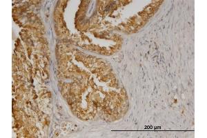 Immunoperoxidase of monoclonal antibody to AGTRAP on formalin-fixed paraffin-embedded human prostate.
