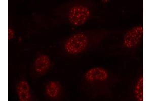 Immunofluorescence staining of methanol-fixed Hela cells using Phospho-MAPKAPK2-T334 antibody. (MAPKAP Kinase 2 anticorps  (pThr334))