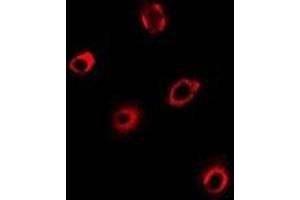 Immunofluorescent analysis of PCMT1 staining in Hela cells. (PCMT1 anticorps)