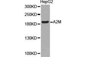 Western Blotting (WB) image for anti-alpha-2-Macroglobulin (A2M) antibody (ABIN1870709) (alpha 2 Macroglobulin anticorps)