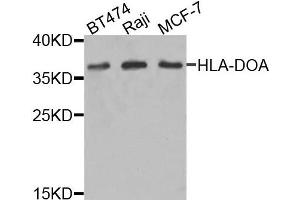 Western blot analysis of extracts of various cells, using HLA-DOA antibody.