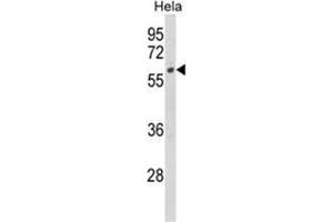 Western blot analysis of CYP7B1 Antibody (Center) in Hela cell line lysates (35ug/lane). (CYP7B1 anticorps  (Middle Region))