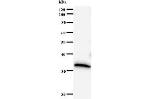 Western Blotting (WB) image for anti-DNA (Cytosine-5-)-Methyltransferase 3 beta (DNMT3B) antibody (ABIN933161) (DNMT3B anticorps)