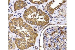 Immunohistochemistry of paraffin-embedded Human kidney using TGS1 Polyclonal Antibody at dilution of 1:100 (40x lens). (TGS1 anticorps)