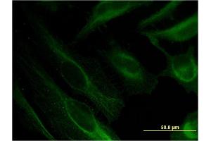 Immunofluorescence of monoclonal antibody to BST2 on HeLa cell.