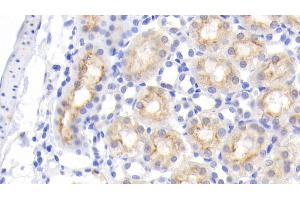 Detection of EGF in Rat Kidney Tissue using Monoclonal Antibody to Epidermal Growth Factor (EGF)