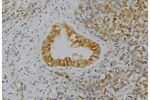 ABIN6277560 at 1/100 staining Human uterus tissue by IHC-P. (WIF1 anticorps  (Internal Region))