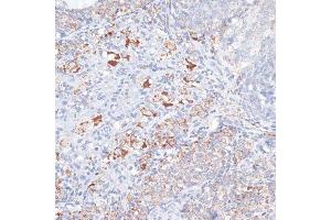 Immunohistochemistry of paraffin-embedded rat ovary using SMPD1 antibody.