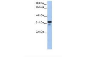 Image no. 1 for anti-Heparan Sulfate (Glucosamine) 3-O-Sulfotransferase 6 (HS3ST6) (AA 218-267) antibody (ABIN6739228) (Heparan Sulfate (Glucosamine) 3-O-Sulfotransferase 6 (HS3ST6) (AA 218-267) anticorps)