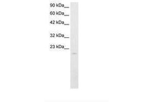 Image no. 1 for anti-SP140 Nuclear Body Protein (SP140) (AA 39-88) antibody (ABIN202038)