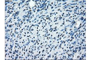 Immunohistochemical staining of paraffin-embedded endometrium tissue using anti-SATB1mouse monoclonal antibody. (SATB1 anticorps)