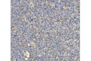 IHC analysis of CCR2 using anti-CCR2 antibody (ABIN7598970).