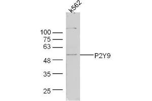 Human k562 lysates probed with Rabbit Anti-P2Y9 Polyclonal Antibody, Unconjugated  at 1:300 overnight at 4˚C. (LPAR4 anticorps  (AA 175-270))