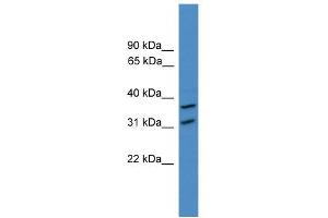 WB Suggested Anti-OTUD6A Antibody Titration: 0.