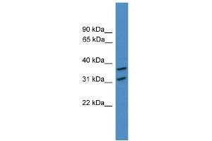 WB Suggested Anti-OTUD6A Antibody Titration: 0. (OTUD6A anticorps  (N-Term))