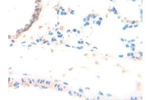 Detection of ADPN in Rat Lung Tissue using Polyclonal Antibody to Adiponectin (ADPN) (ADIPOQ anticorps  (AA 111-244))