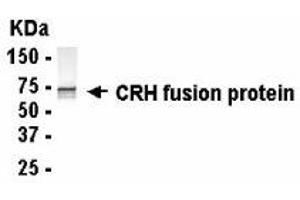 Western Blotting (WB) image for anti-Corticotropin Releasing Hormone (CRH) (AA 27-196) antibody (ABIN2467797) (CRH anticorps  (AA 27-196))