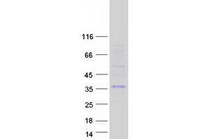 Validation with Western Blot (CTDSPL Protein (Transcript Variant 2) (Myc-DYKDDDDK Tag))