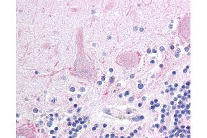 Anti-AFF1 antibody IHC of human brain, cerebellum. (AF4 anticorps  (AA 1190-1203))