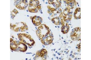 Immunohistochemistry of paraffin-embedded Human stomach using RIPK4 Polyclonal Antibody at dilution of 1:100 (40x lens). (RIPK4 anticorps)