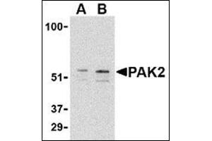 Western blot analysis of PAK2 in Jurkat lysate with this product at (A) 0. (PAK2 anticorps  (C-Term))