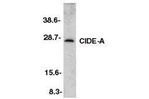 Western blot analysis of CIDE-A in murine heart tissue lysate with CIDE-A antibody at 2ug/ml. (CIDEA anticorps  (AA 200-214))